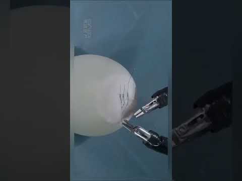 Remote Robotic Surgery with the Da Vinci System: A Leap in Medical Innovation