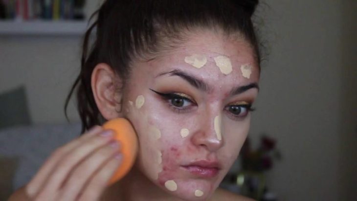 garota colocando maquiagem na pele irritada 